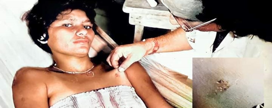 Depoimentos de Testemunhas do Chupa-Chupa